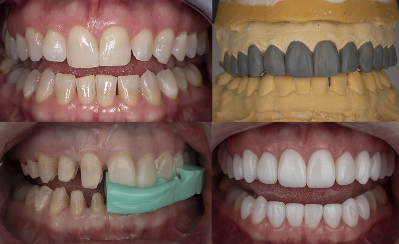 Mastering Full Arch to Full Mouth Rehab course tile image