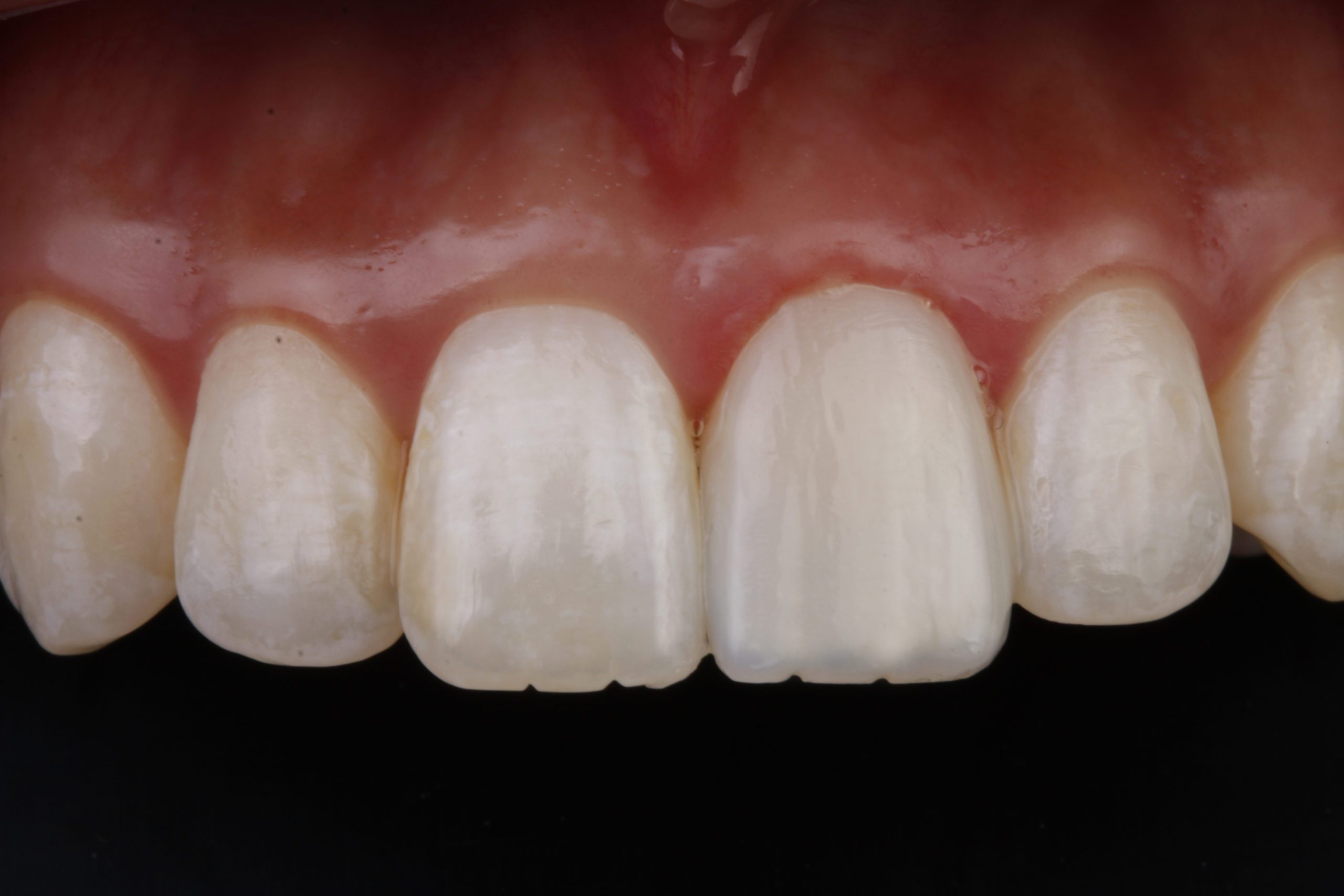 Composite Bonding with Dr. David Chan/ COURSE FULL!  Fill out ‘Contact Us’ form to get on a waitlist. course tile image